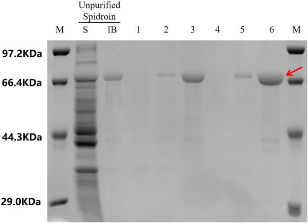 https://cdn.ncbi.nlm.nih.gov/pmc/blobs/87a7/12058734/9e30603e6754/fbioe-13-1587546-g010.jpg