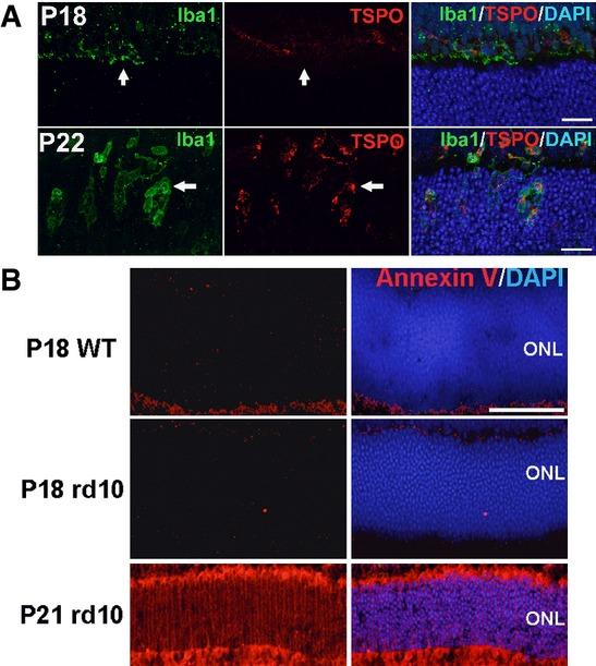 https://cdn.ncbi.nlm.nih.gov/pmc/blobs/87af/4568951/7bee56cbcd32/emmm0007-1179-f10ev.jpg