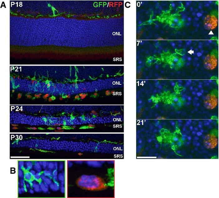 https://cdn.ncbi.nlm.nih.gov/pmc/blobs/87af/4568951/9ebfdcc6441c/emmm0007-1179-f12ev.jpg