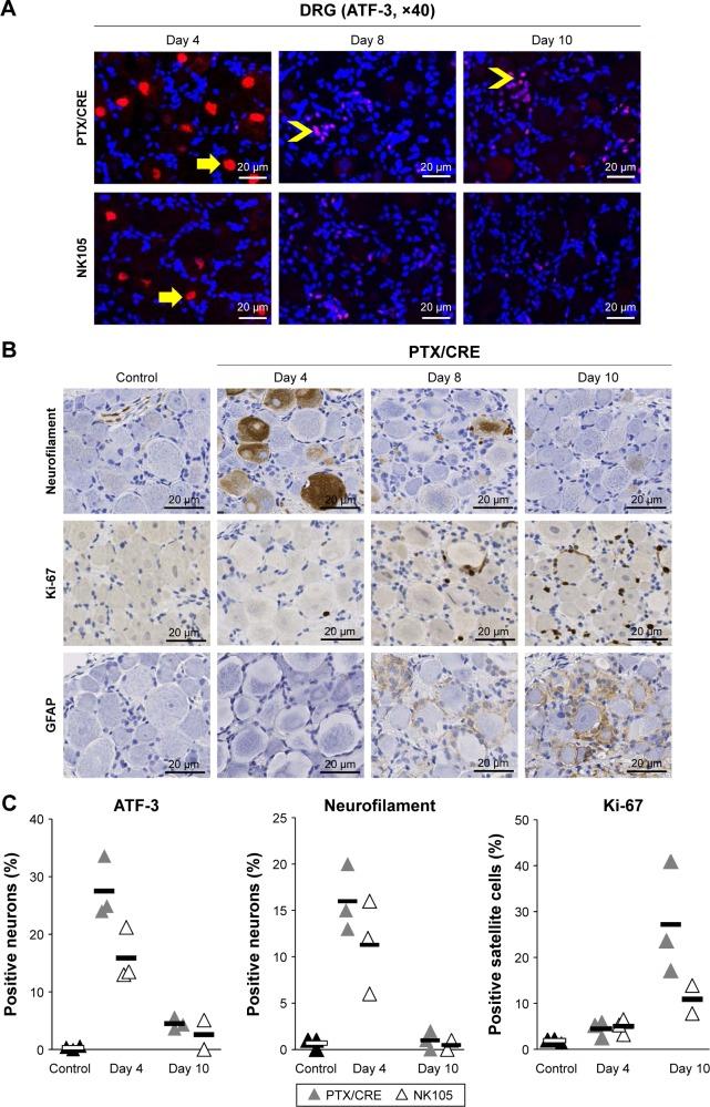 https://cdn.ncbi.nlm.nih.gov/pmc/blobs/87b5/5317268/c3c4dbc7f4e2/ijn-12-1293Fig4.jpg