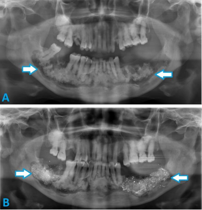 https://cdn.ncbi.nlm.nih.gov/pmc/blobs/87b8/12058939/92553cefdd6d/10006_2025_1394_Fig3_HTML.jpg