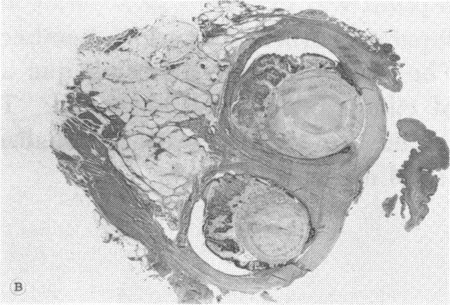 https://cdn.ncbi.nlm.nih.gov/pmc/blobs/87ba/1311562/146796b1efe2/taos00024-0525-b.jpg