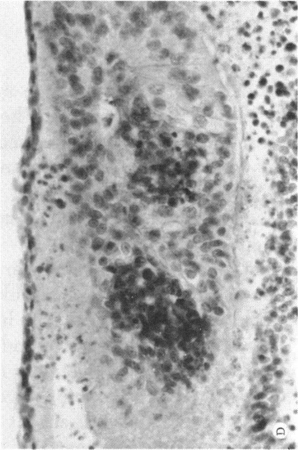 https://cdn.ncbi.nlm.nih.gov/pmc/blobs/87ba/1311562/9c302e3b649b/taos00024-0535-d.jpg