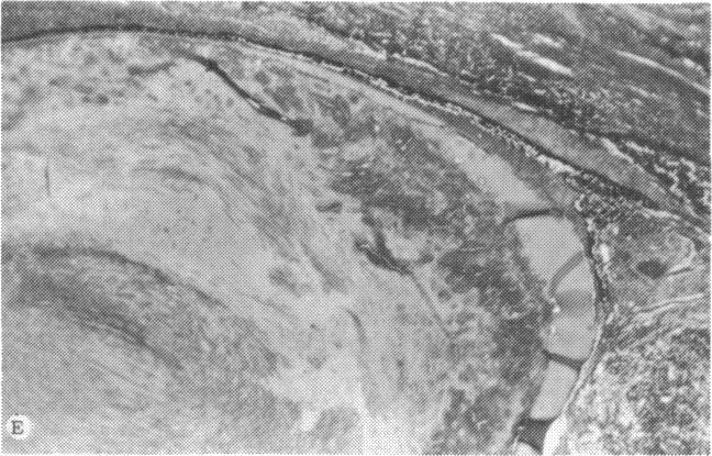 https://cdn.ncbi.nlm.nih.gov/pmc/blobs/87ba/1311562/bffba2a137a6/taos00024-0525-e.jpg