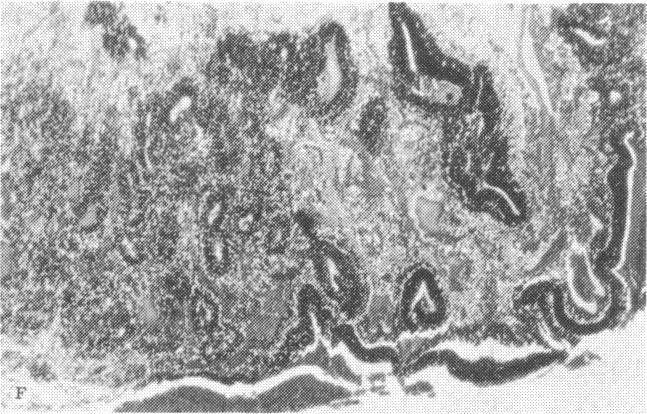 https://cdn.ncbi.nlm.nih.gov/pmc/blobs/87ba/1311562/c4d33256371c/taos00024-0525-f.jpg