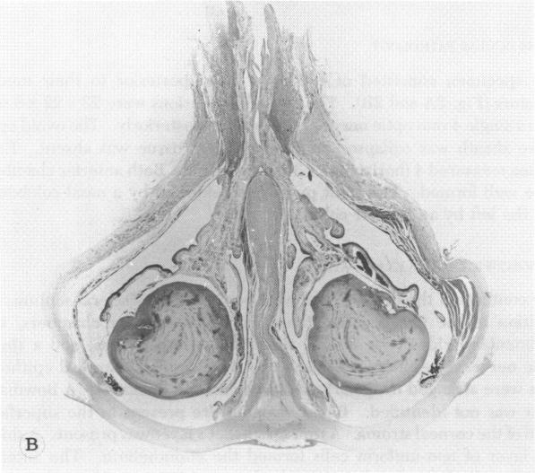 https://cdn.ncbi.nlm.nih.gov/pmc/blobs/87ba/1311562/eddcfc49c423/taos00024-0530-b.jpg
