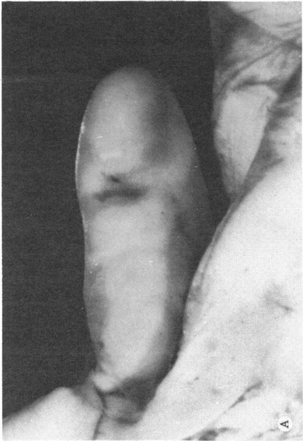 https://cdn.ncbi.nlm.nih.gov/pmc/blobs/87ba/1311562/ef7367b7d188/taos00024-0535-a.jpg