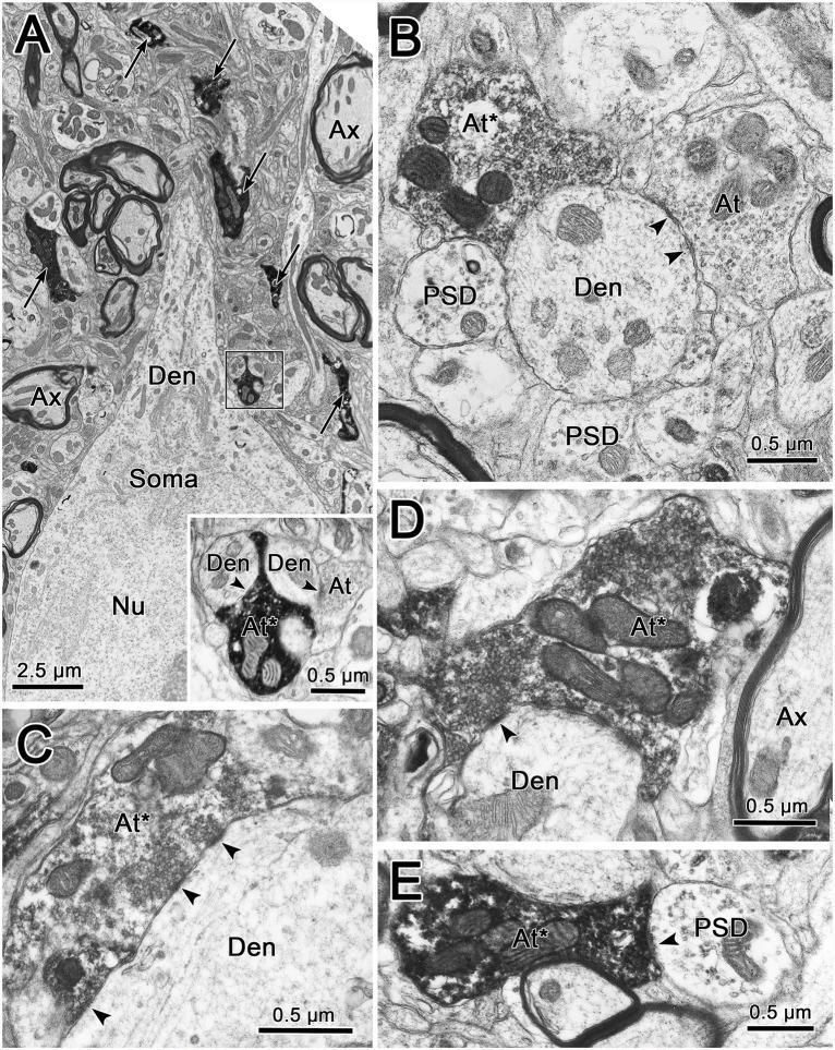 https://cdn.ncbi.nlm.nih.gov/pmc/blobs/87ba/7525072/d19c033735de/fnana-14-562673-g0009.jpg
