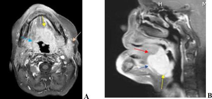 https://cdn.ncbi.nlm.nih.gov/pmc/blobs/87bb/11164311/884c6243525c/ijp-19-107-g001.jpg