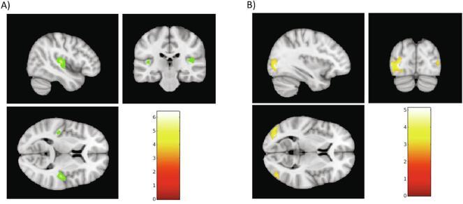 https://cdn.ncbi.nlm.nih.gov/pmc/blobs/87bd/7777537/1161266ce26a/gr3.jpg