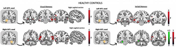 https://cdn.ncbi.nlm.nih.gov/pmc/blobs/87c1/9804196/37456dcfaace/EPI-63-2597-g001.jpg