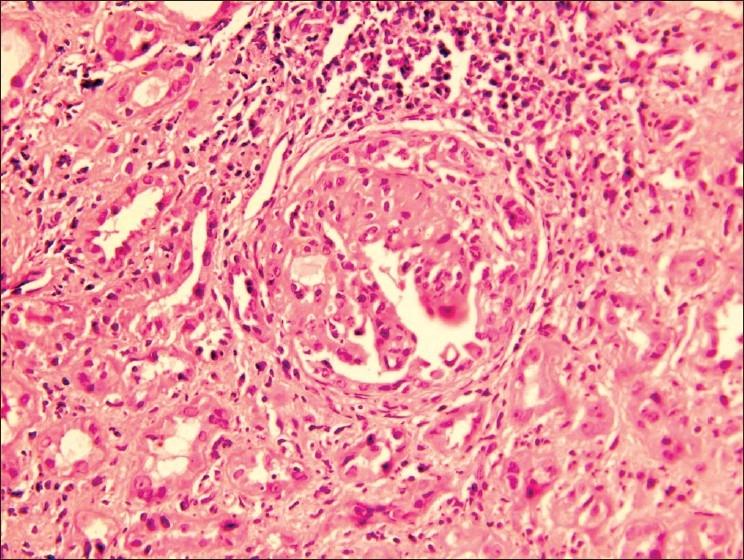 https://cdn.ncbi.nlm.nih.gov/pmc/blobs/87c2/2813536/3fe050fc1129/IJN-18-169-g001.jpg