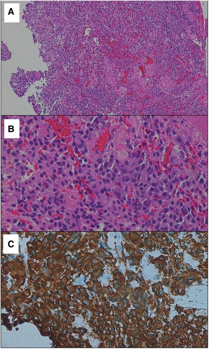 https://cdn.ncbi.nlm.nih.gov/pmc/blobs/87ce/11986810/547740a28f09/luaf079f4.jpg