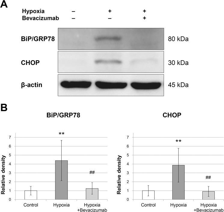 https://cdn.ncbi.nlm.nih.gov/pmc/blobs/87ce/5462411/44f41c662a02/pone.0179048.g006.jpg