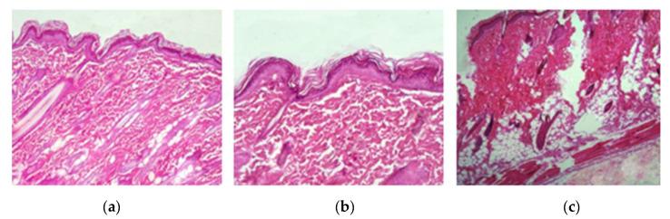 https://cdn.ncbi.nlm.nih.gov/pmc/blobs/87ce/9689900/21d3832c6208/gels-08-00746-g007.jpg