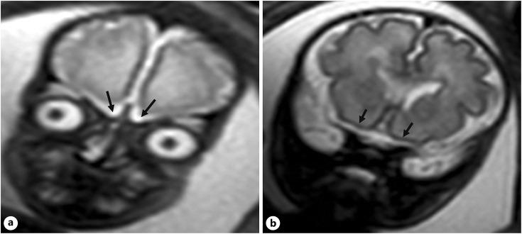 https://cdn.ncbi.nlm.nih.gov/pmc/blobs/87de/12129418/ca45662f5499/fdt-2025-0052-0003-543190_F04.jpg