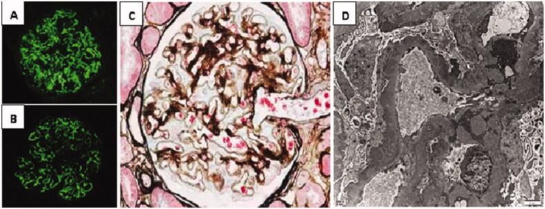 https://cdn.ncbi.nlm.nih.gov/pmc/blobs/87e6/9067982/7fae16e5579d/IRNF_A_2068442_F0001_C.jpg