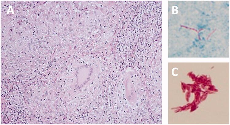 https://cdn.ncbi.nlm.nih.gov/pmc/blobs/87e7/7580769/b8c4153f2ae5/ICRP_A_1830775_F0002_C.jpg