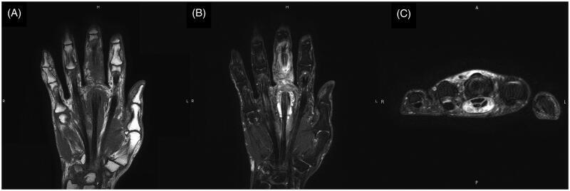 https://cdn.ncbi.nlm.nih.gov/pmc/blobs/87e7/7580769/bb7207747b99/ICRP_A_1830775_F0004_B.jpg