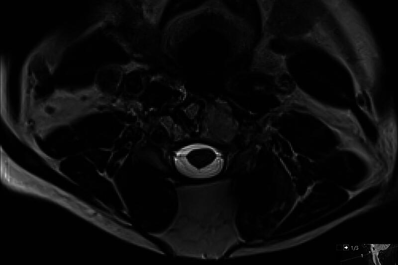 https://cdn.ncbi.nlm.nih.gov/pmc/blobs/87f4/12045538/8c4b4ada5b85/gox-13-e6732-g013.jpg