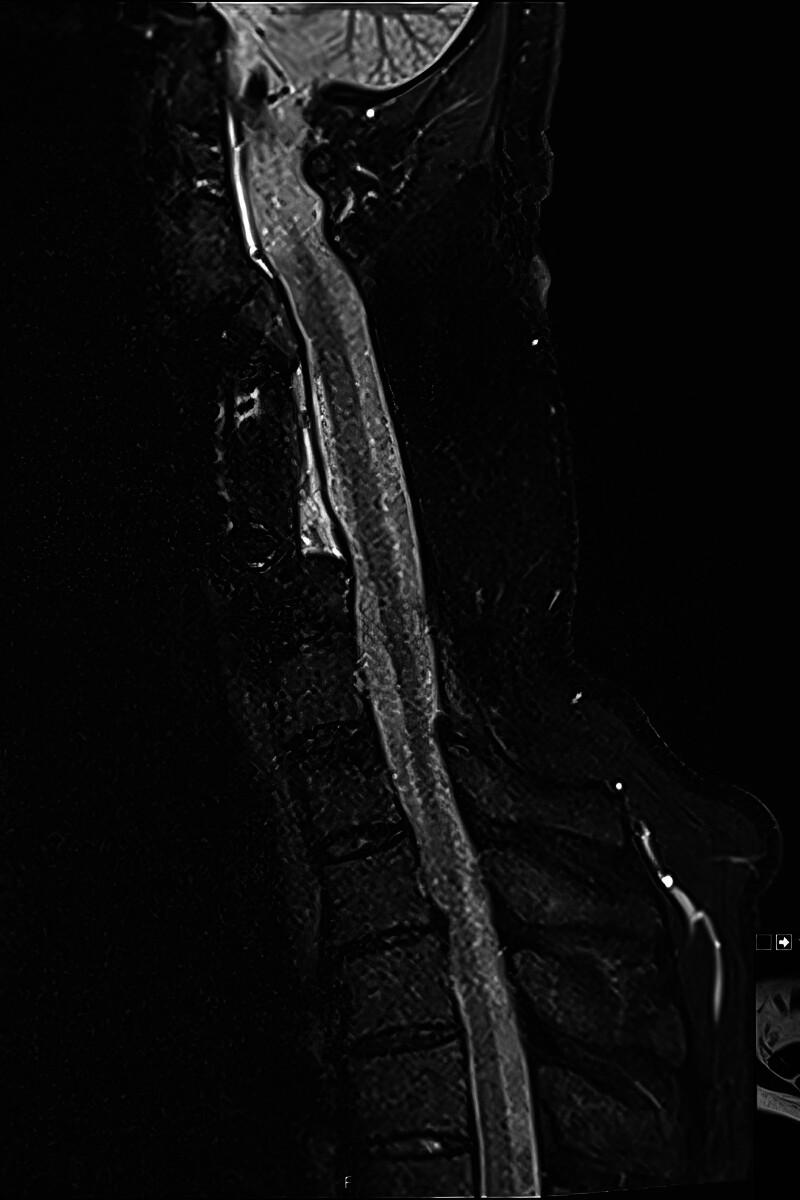 https://cdn.ncbi.nlm.nih.gov/pmc/blobs/87f4/12045538/f4196604f45c/gox-13-e6732-g012.jpg