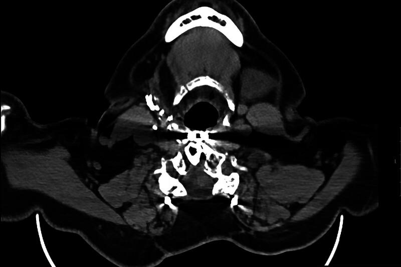 https://cdn.ncbi.nlm.nih.gov/pmc/blobs/87f4/12045538/f8e4a4d0d3f0/gox-13-e6732-g011.jpg