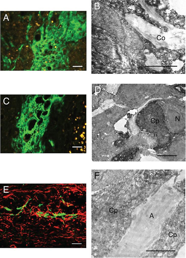 https://cdn.ncbi.nlm.nih.gov/pmc/blobs/87f6/4927912/b3a76e90da90/rnn-34-rnn150546-g008.jpg