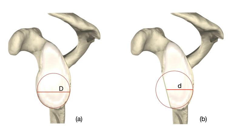 https://cdn.ncbi.nlm.nih.gov/pmc/blobs/87fa/10313462/060000094189/BJO-2023-0066.R1-galleyfig4.jpg