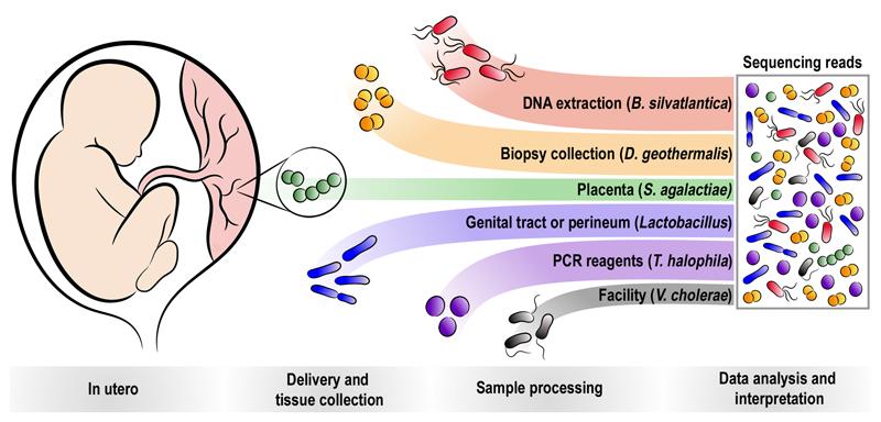 https://cdn.ncbi.nlm.nih.gov/pmc/blobs/8805/6697540/6f5be52a52d8/EMS83569-f004.jpg