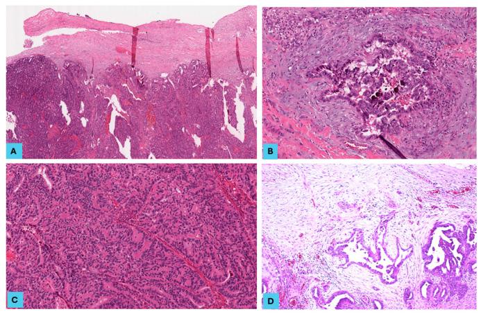 https://cdn.ncbi.nlm.nih.gov/pmc/blobs/880c/11545192/776e48f4d4c1/cancers-16-03611-g003.jpg