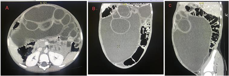 https://cdn.ncbi.nlm.nih.gov/pmc/blobs/8810/8536513/4918b43c3d58/gr1.jpg