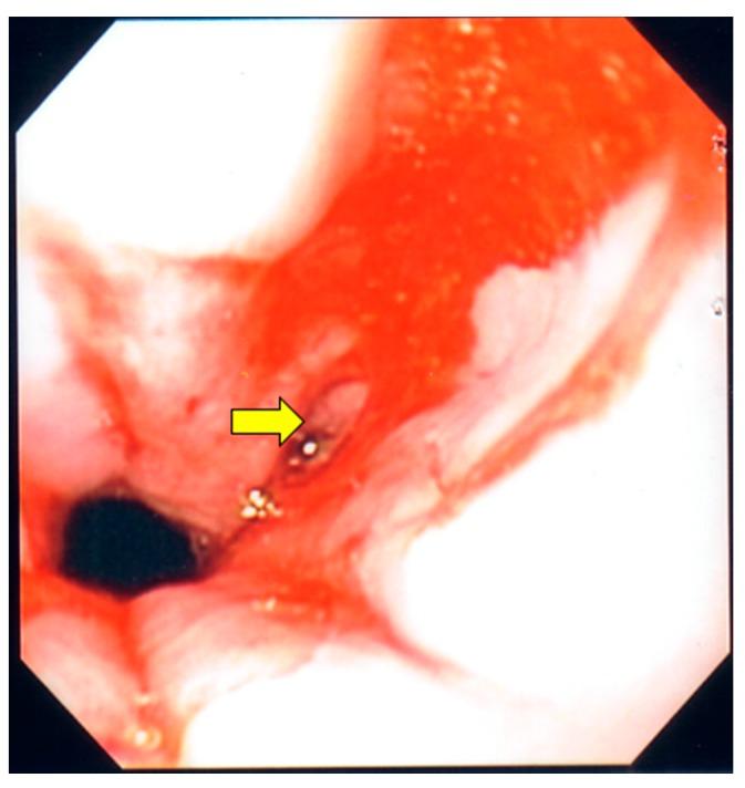 https://cdn.ncbi.nlm.nih.gov/pmc/blobs/8813/5750541/c5f53c25ed28/diseases-05-00030-g002.jpg