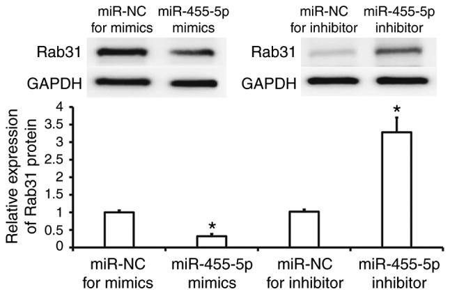 https://cdn.ncbi.nlm.nih.gov/pmc/blobs/8816/6257302/60a694e70110/etm-16-06-4959-g03.jpg