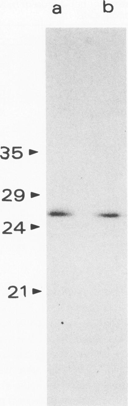 https://cdn.ncbi.nlm.nih.gov/pmc/blobs/881d/1877598/e458a4460b76/amjpathol00104-0011-a.jpg