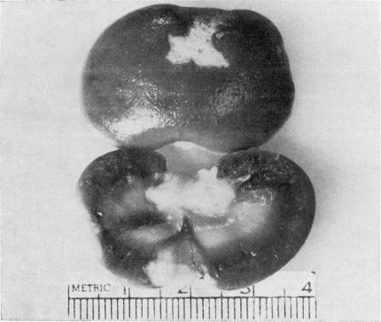 https://cdn.ncbi.nlm.nih.gov/pmc/blobs/8823/2591716/640c106467c4/yjbm00167-0027-b.jpg
