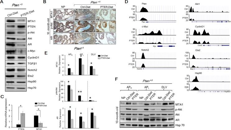 https://cdn.ncbi.nlm.nih.gov/pmc/blobs/8827/4951302/73cfe1008d62/oncotarget-07-18469-g005.jpg