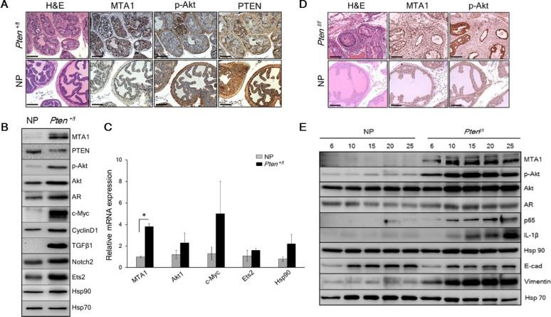 https://cdn.ncbi.nlm.nih.gov/pmc/blobs/8827/4951302/940d220a0173/oncotarget-07-18469-g001.jpg