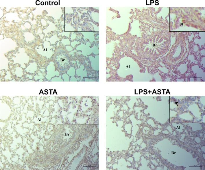 https://cdn.ncbi.nlm.nih.gov/pmc/blobs/8829/12069755/3f1c0bf74ade/TOX-40-924-g004.jpg