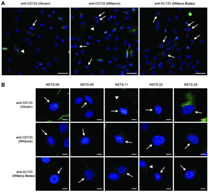 https://cdn.ncbi.nlm.nih.gov/pmc/blobs/882e/4494592/a642c2313e53/IJMM-36-01-0065-g01.jpg