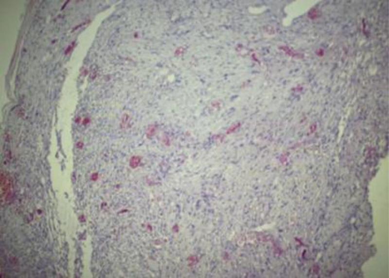 https://cdn.ncbi.nlm.nih.gov/pmc/blobs/882f/10470736/59e2f8164349/medi-102-e34966-g002.jpg