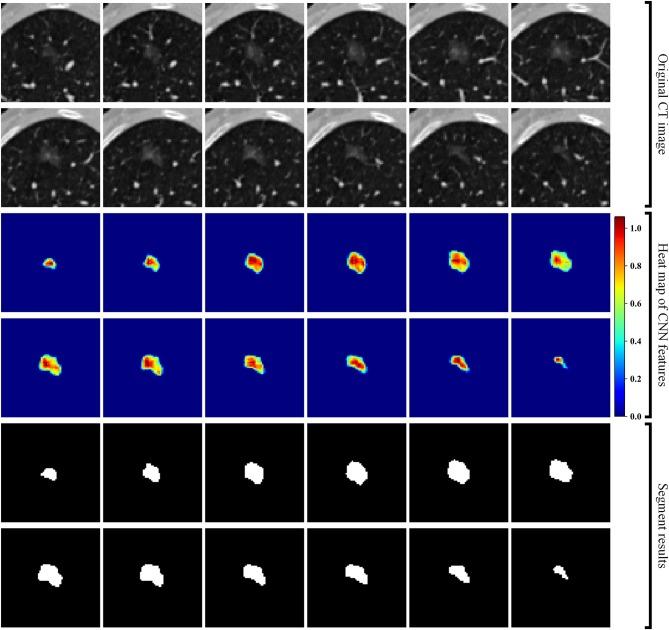 https://cdn.ncbi.nlm.nih.gov/pmc/blobs/882f/7136522/1539ff21af89/fonc-10-00418-g0002.jpg