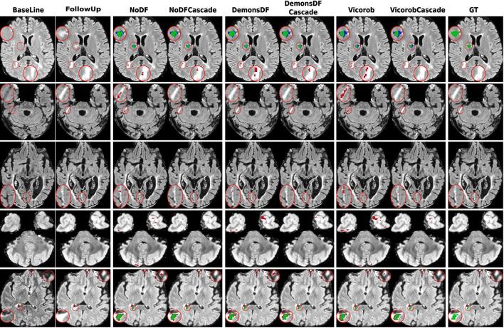 https://cdn.ncbi.nlm.nih.gov/pmc/blobs/883a/9730806/52fae2ae771a/fnins-16-1007619-g0004.jpg