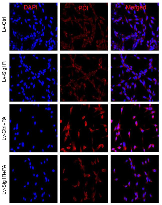 https://cdn.ncbi.nlm.nih.gov/pmc/blobs/883e/8971912/8f48c5311b91/mmr-25-05-12686-g04.jpg