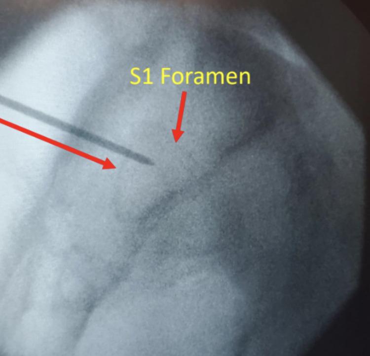 https://cdn.ncbi.nlm.nih.gov/pmc/blobs/8848/9034860/2e8bcf081004/JPR-15-1149-g0002.jpg