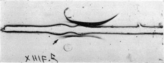 https://cdn.ncbi.nlm.nih.gov/pmc/blobs/884f/1422841/349a3e651061/immunology00330-0093-a.jpg