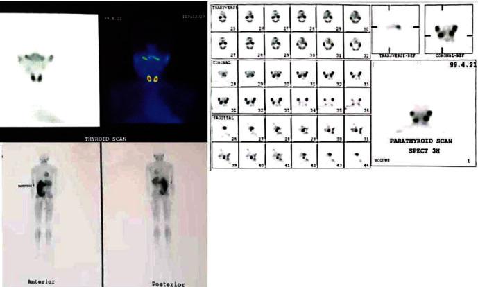 https://cdn.ncbi.nlm.nih.gov/pmc/blobs/8850/10845258/e465dc5de9cc/CRID2023-5410229.004.jpg