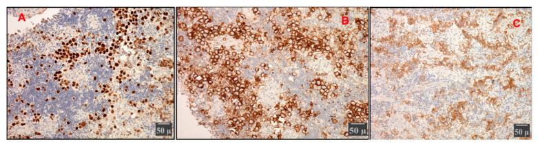 https://cdn.ncbi.nlm.nih.gov/pmc/blobs/8852/12071314/aa16581fba89/cancers-17-01566-g022.jpg