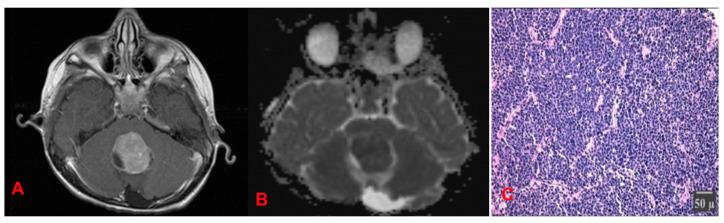 https://cdn.ncbi.nlm.nih.gov/pmc/blobs/8852/12071314/d7549d754921/cancers-17-01566-g017.jpg