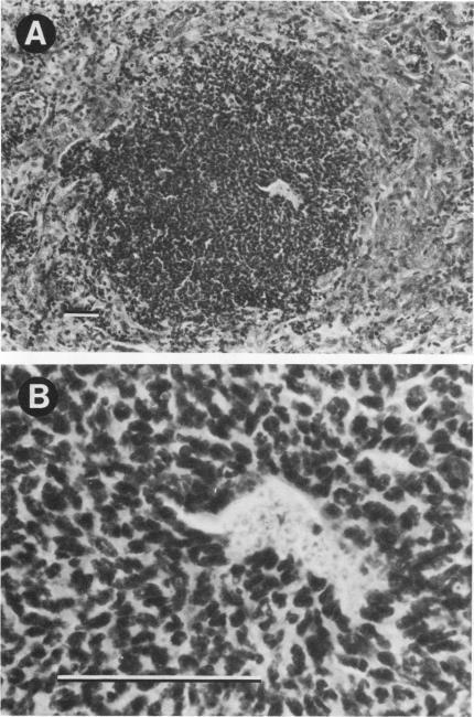 https://cdn.ncbi.nlm.nih.gov/pmc/blobs/8854/261400/0195c2d808cd/iai00120-0247-a.jpg