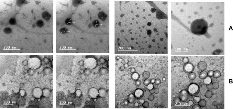 https://cdn.ncbi.nlm.nih.gov/pmc/blobs/8855/8318821/4bed24c309ec/IJN-16-4985-g0005.jpg